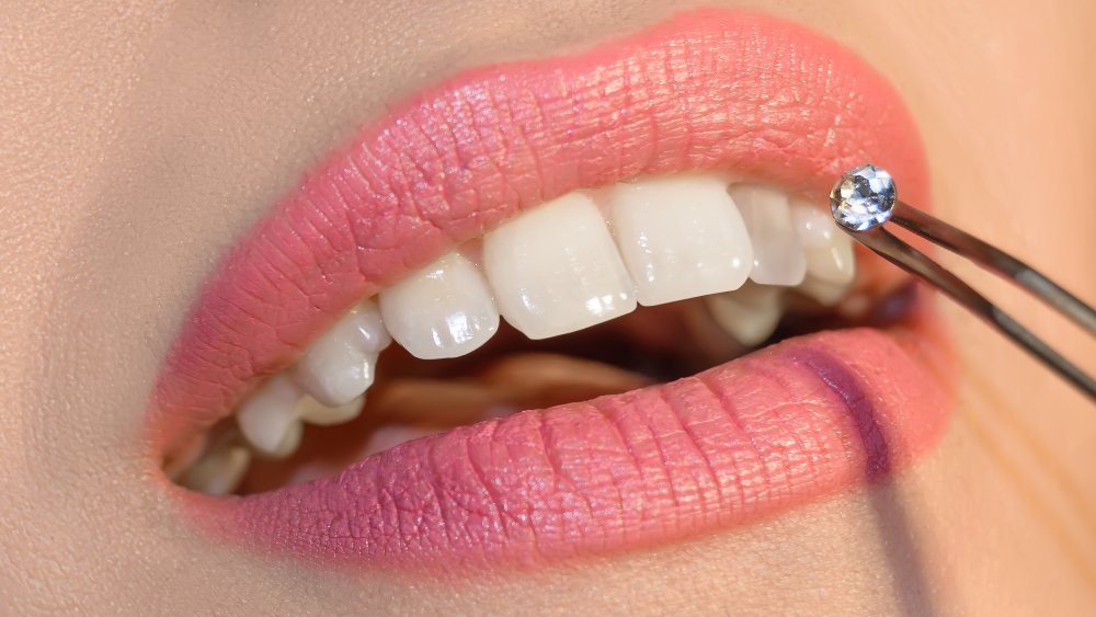 Are Tooth Gems Bad For Your Teeth? The Dangers Of This Sparkly Trend