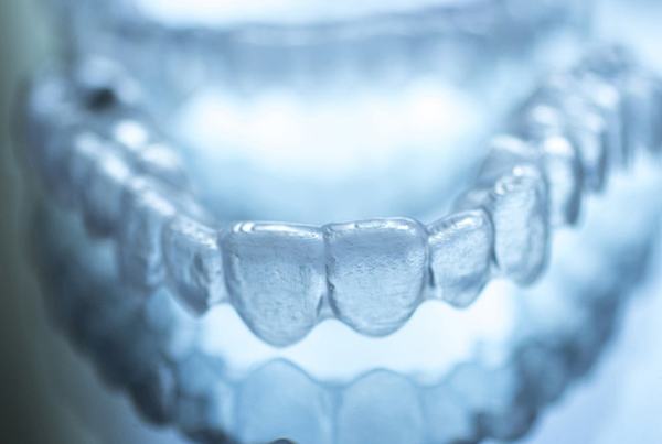 Orthodontist Surrey - Invisalign Invisible Braces Surrey